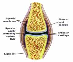 arthritis graphic